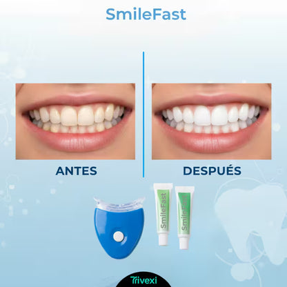 SmileFast™: Blanqueamiento LED Avanzado