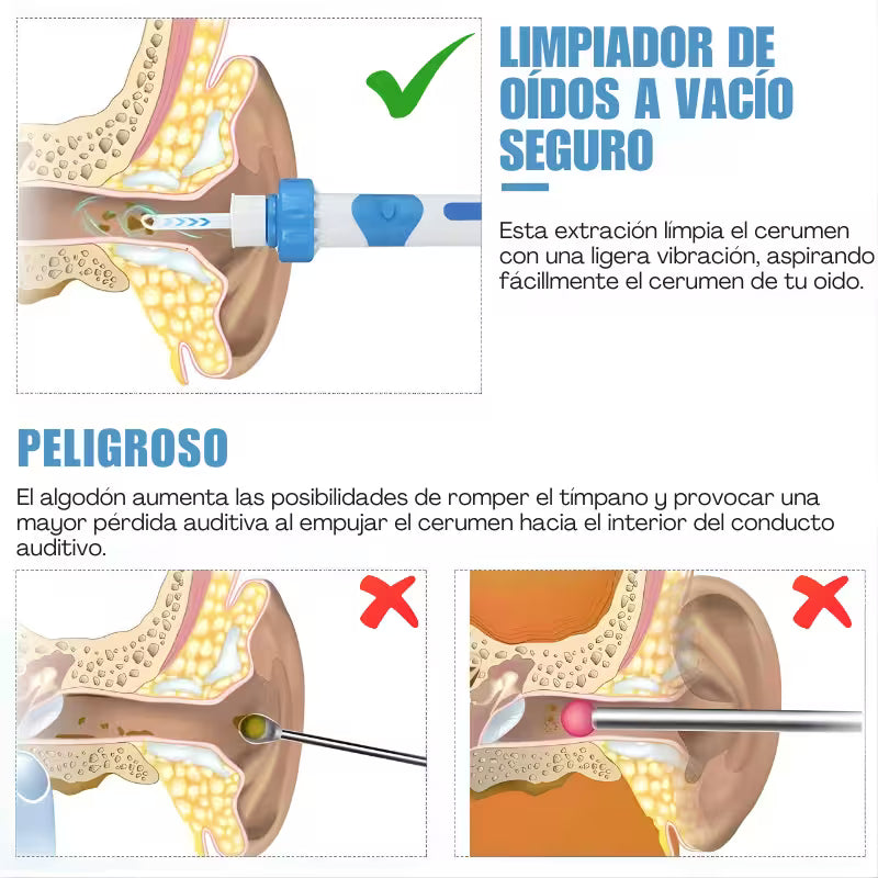 EarPro™: El fin del taponamiento auditivo.